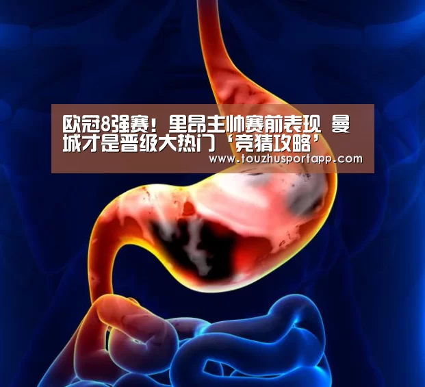欧冠8强赛!里昂主帅赛前表现 曼城才是晋级大热门‘竞猜攻略’(图3) 世界杯投注